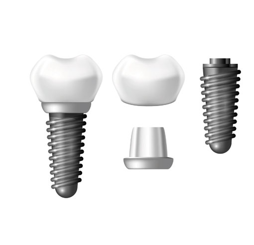 CNC Titanium Machining